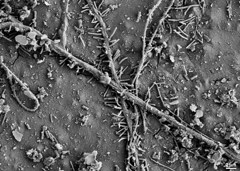 Rasterelektronenmikroskopische Aufnahme von Mikroorganismen, die das Polymer nach sechs Wochen im Boden besiedeln (© Michael Zumstein, with equipment maintained by the Center for Microscopy and Image Analysis, University of Zurich).